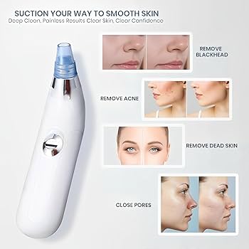 4-in-1 Electric Blackhead Remover Vacuum – Pore Cleaner & Acne Extractor Tool